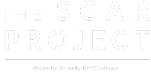 The Scar Project