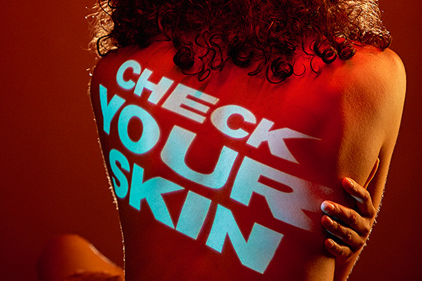 Check Your Skin